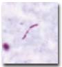 tubercule bacillus