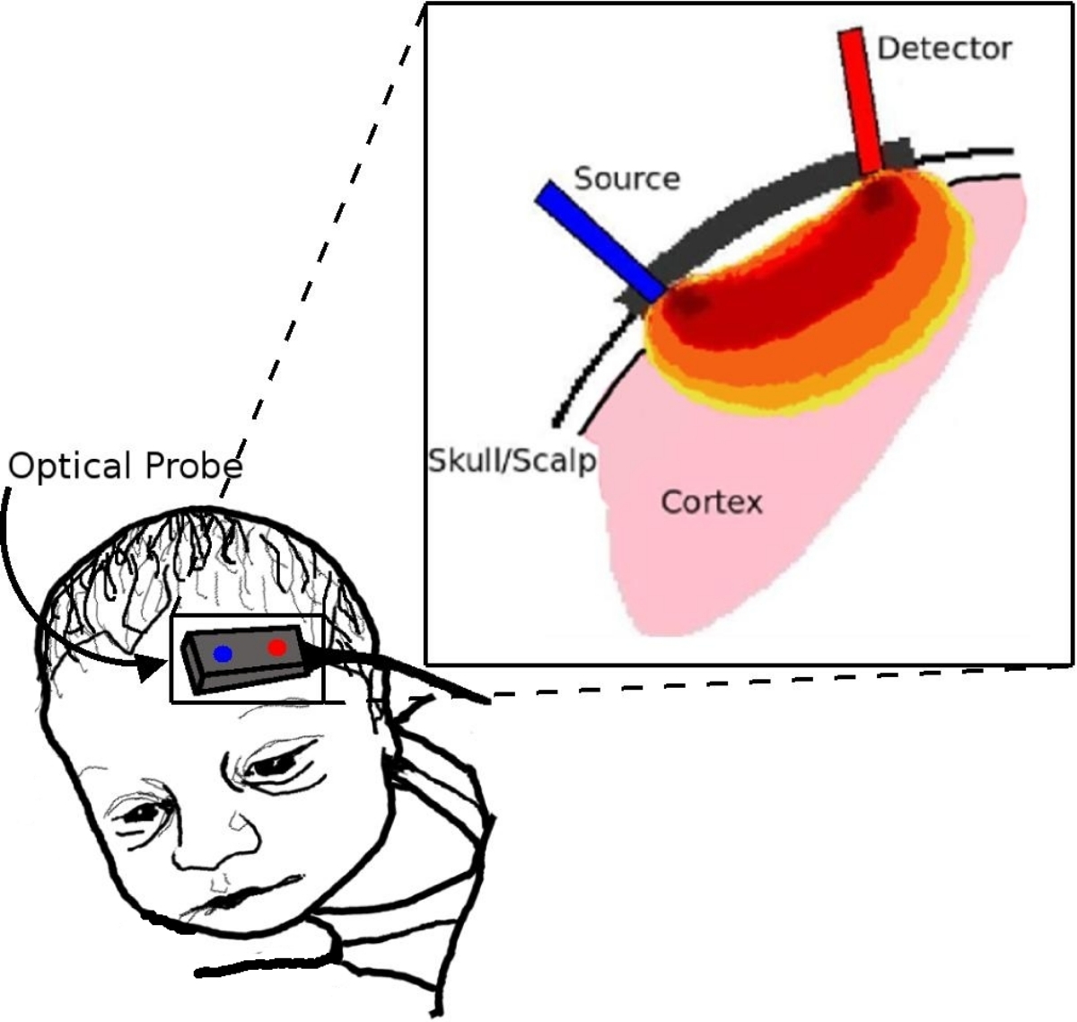 baby with optical probe