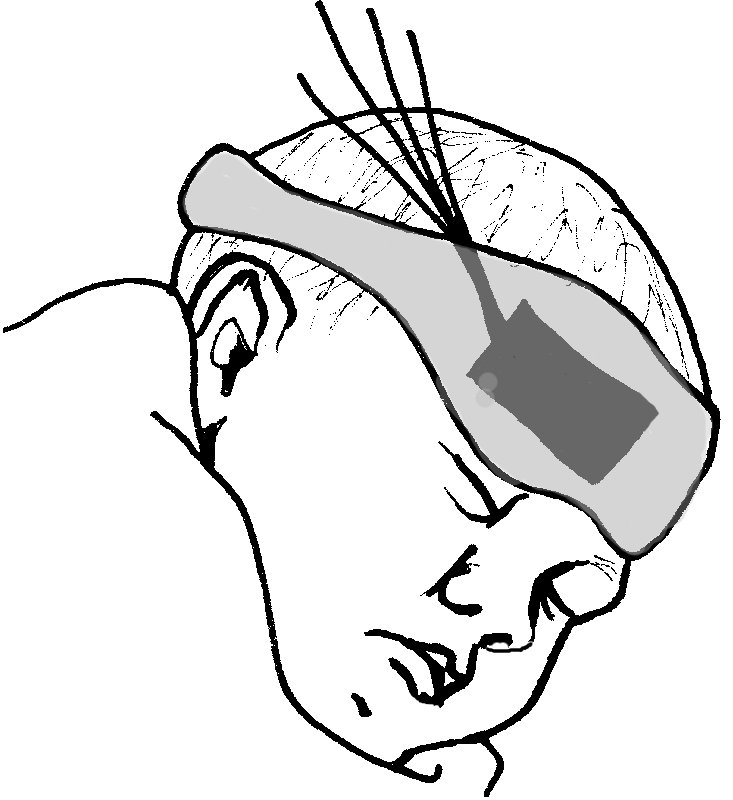 Optical probe on the head on an infant.